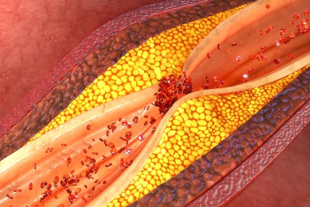 Loại cá giàu chất béo nhưng lại giúp kiểm soát mỡ máu, ‘quét sạch’ cholesterol thừa thãi- Ảnh 1.